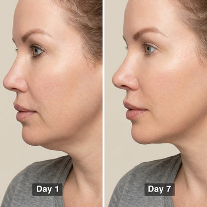 Lymphatic Sculpting Brush™