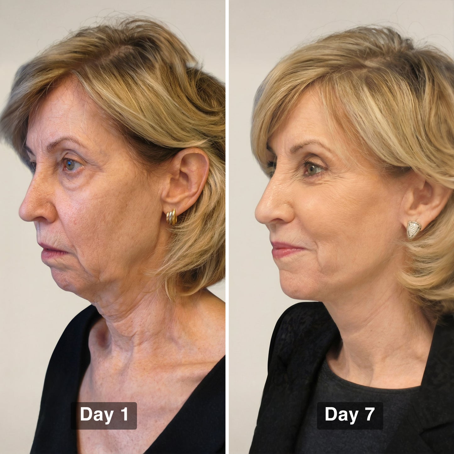 Lymphatic Sculpting Brush™